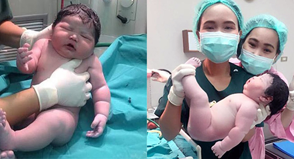 Oh My Gosh, Mum Gives Birth To A ‘Chubby’ Newborn Baby Who Weighed11,464 lbs Featured Image